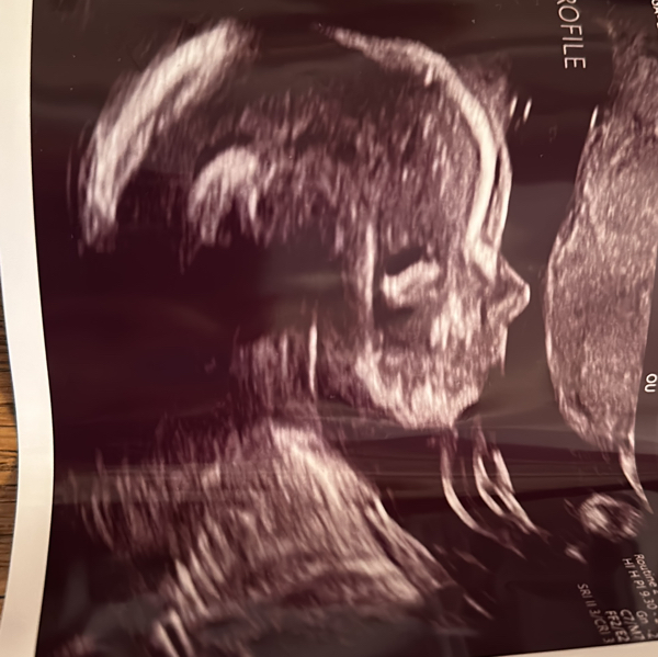 Babylist Registry Photo.