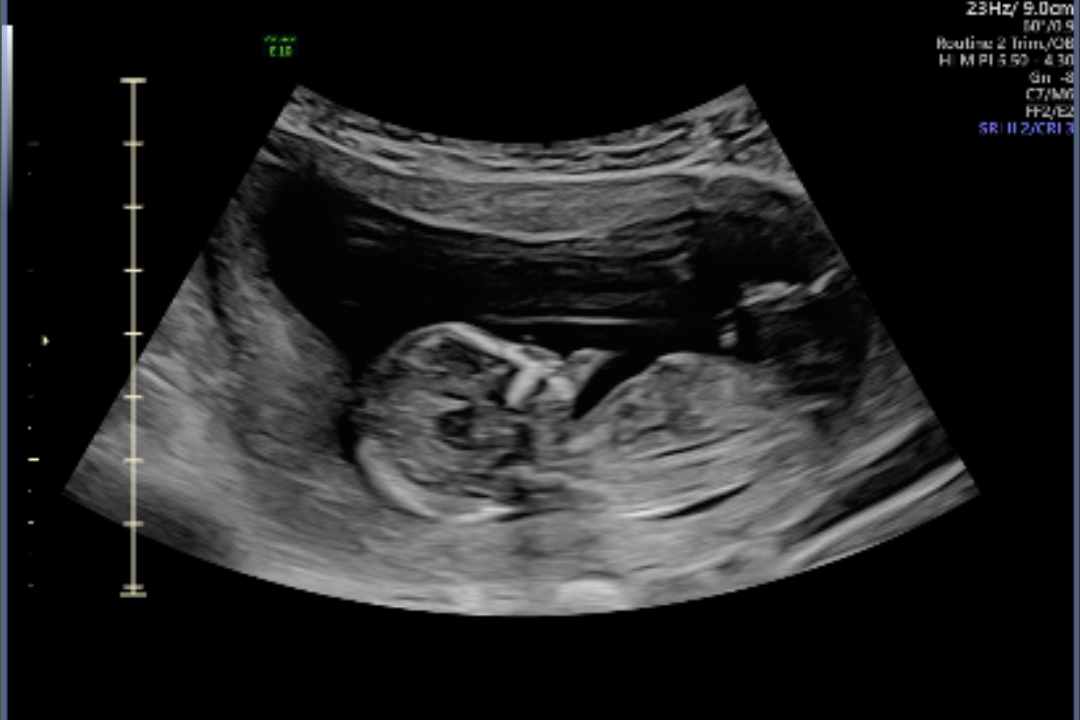 Babylist Registry Photo.