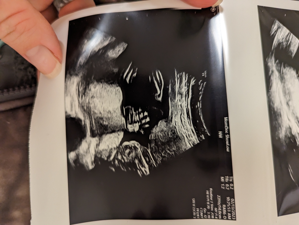 Babylist Registry Photo.
