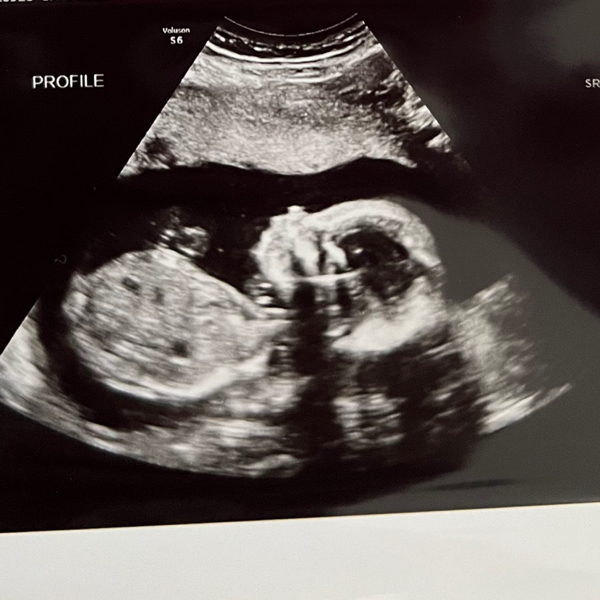 Babylist Registry Photo.