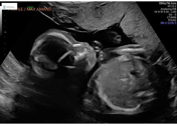 Babylist Registry Photo.