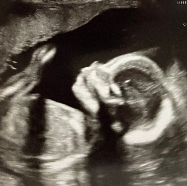 Babylist Registry Photo.
