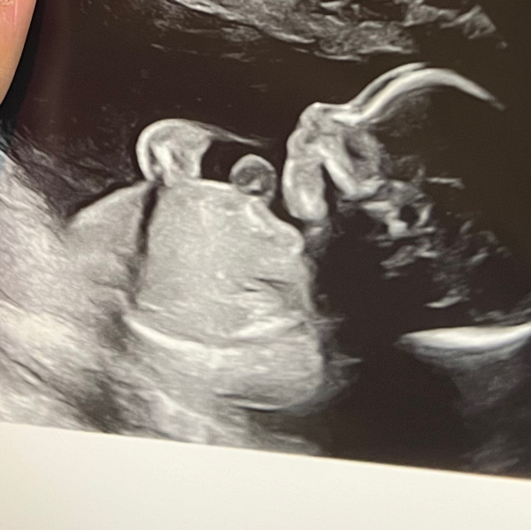 Babylist Registry Photo.