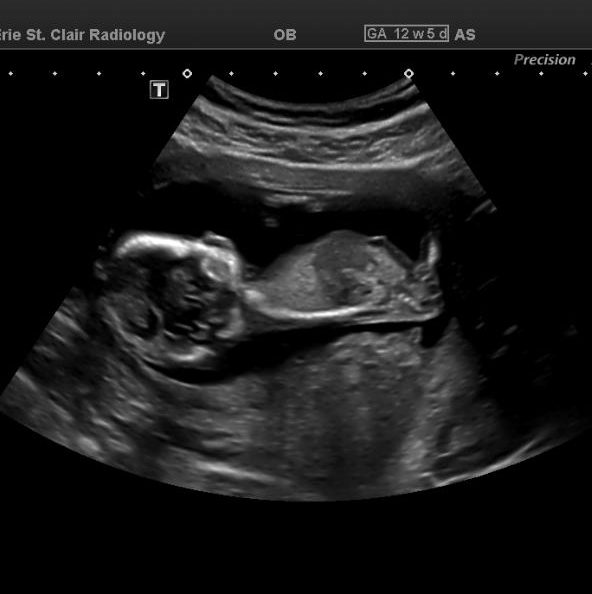 Babylist Registry Photo.