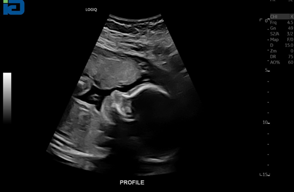 Babylist Registry Photo.