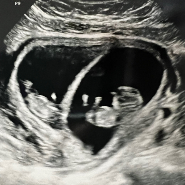 Babylist Registry Photo.