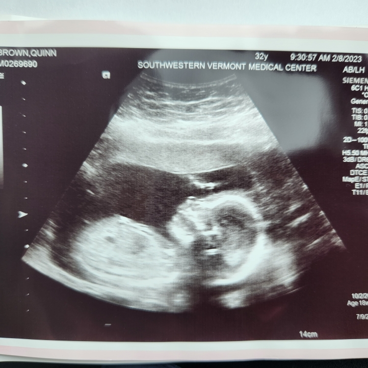 Babylist Registry Photo.