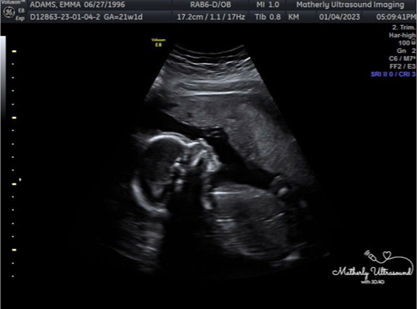 Babylist Registry Photo.