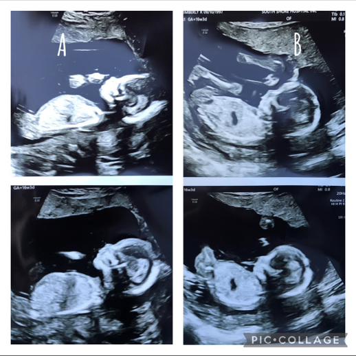 Babylist Registry Photo.