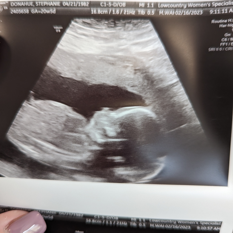 Babylist Registry Photo.