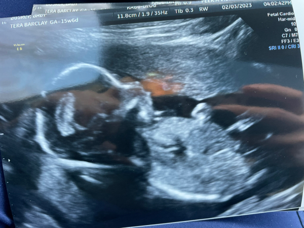 Babylist Registry Photo.