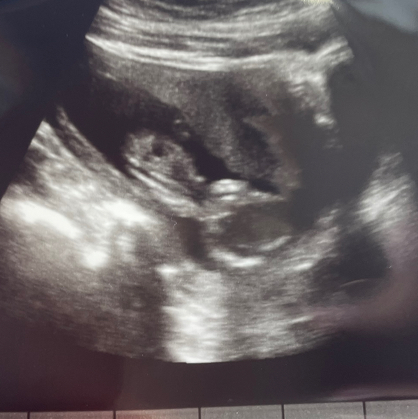 Babylist Registry Photo.