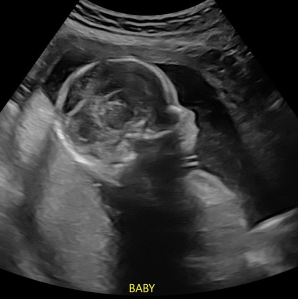 Babylist Registry Photo.