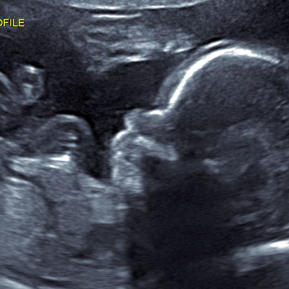 Babylist Registry Photo.