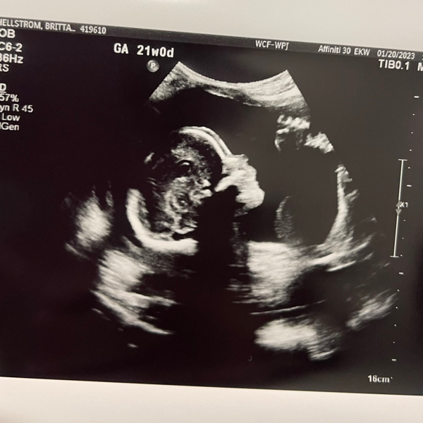 Babylist Registry Photo.