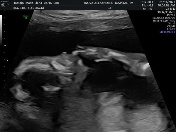 Babylist Registry Photo.
