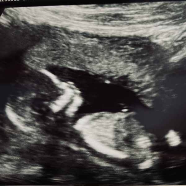 Babylist Registry Photo.