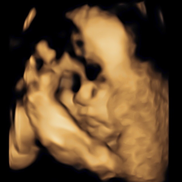 Babylist Registry Photo.