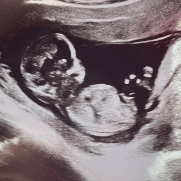 Babylist Registry Photo.
