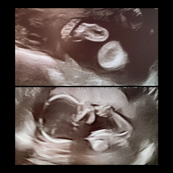 Babylist Registry Photo.