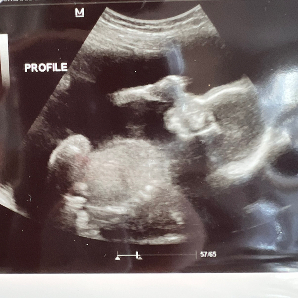 Babylist Registry Photo.
