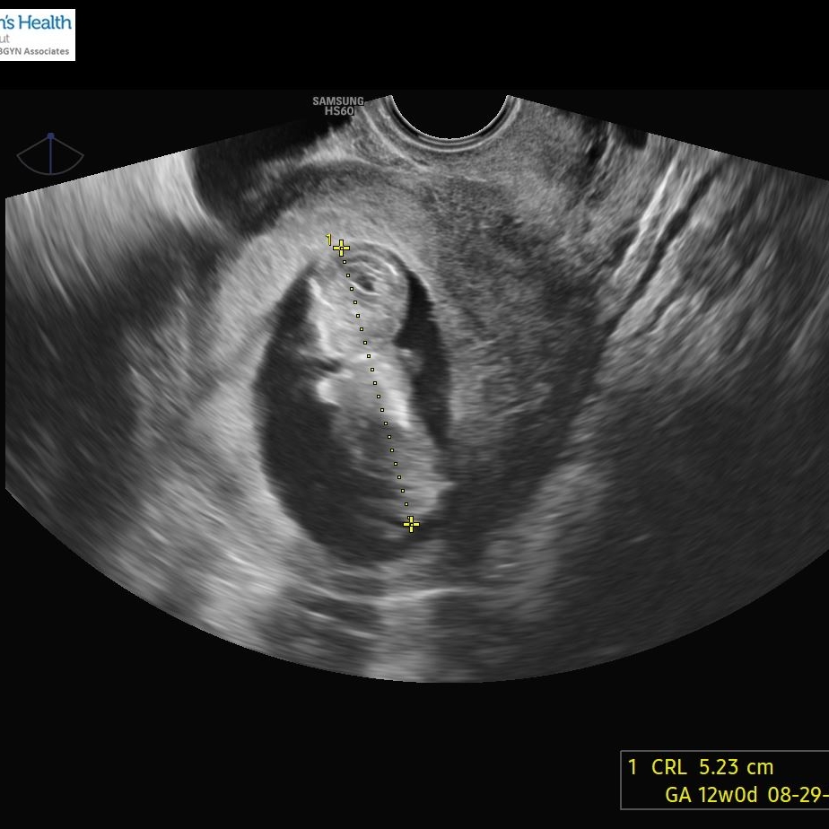 Babylist Registry Photo.