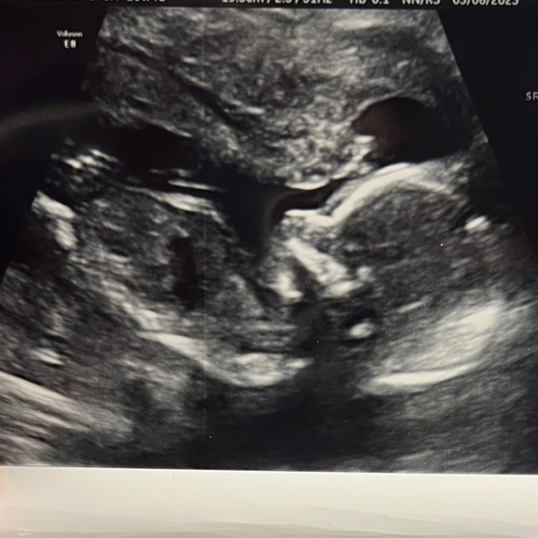Babylist Registry Photo.
