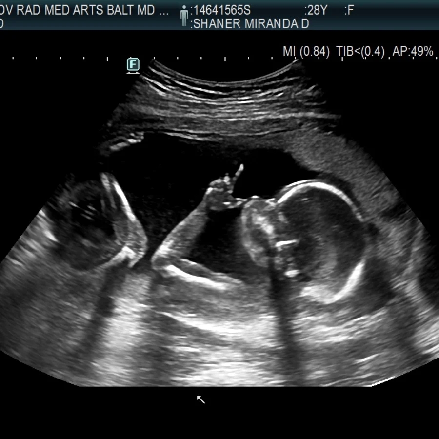 Babylist Registry Photo.