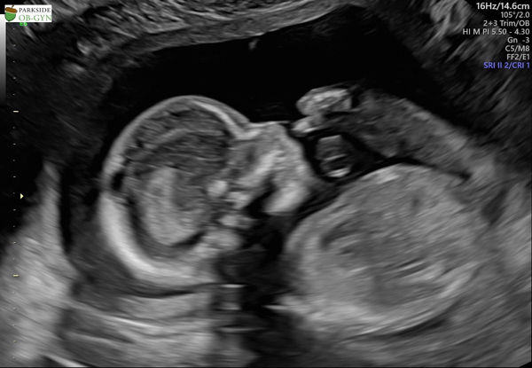 Babylist Registry Photo.