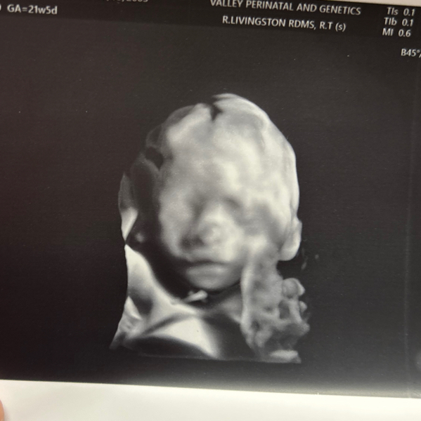 Babylist Registry Photo.