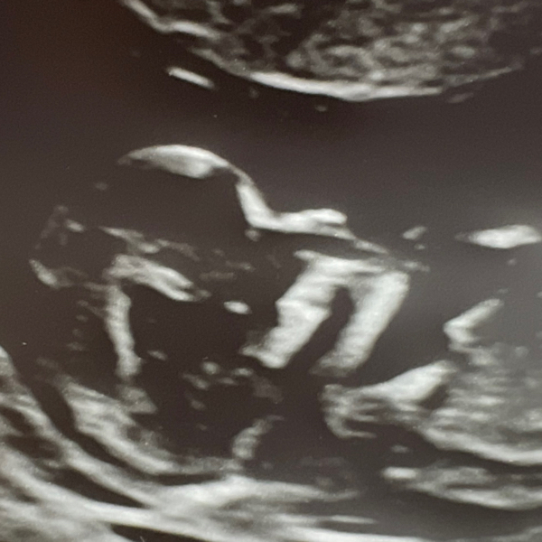 Babylist Registry Photo.