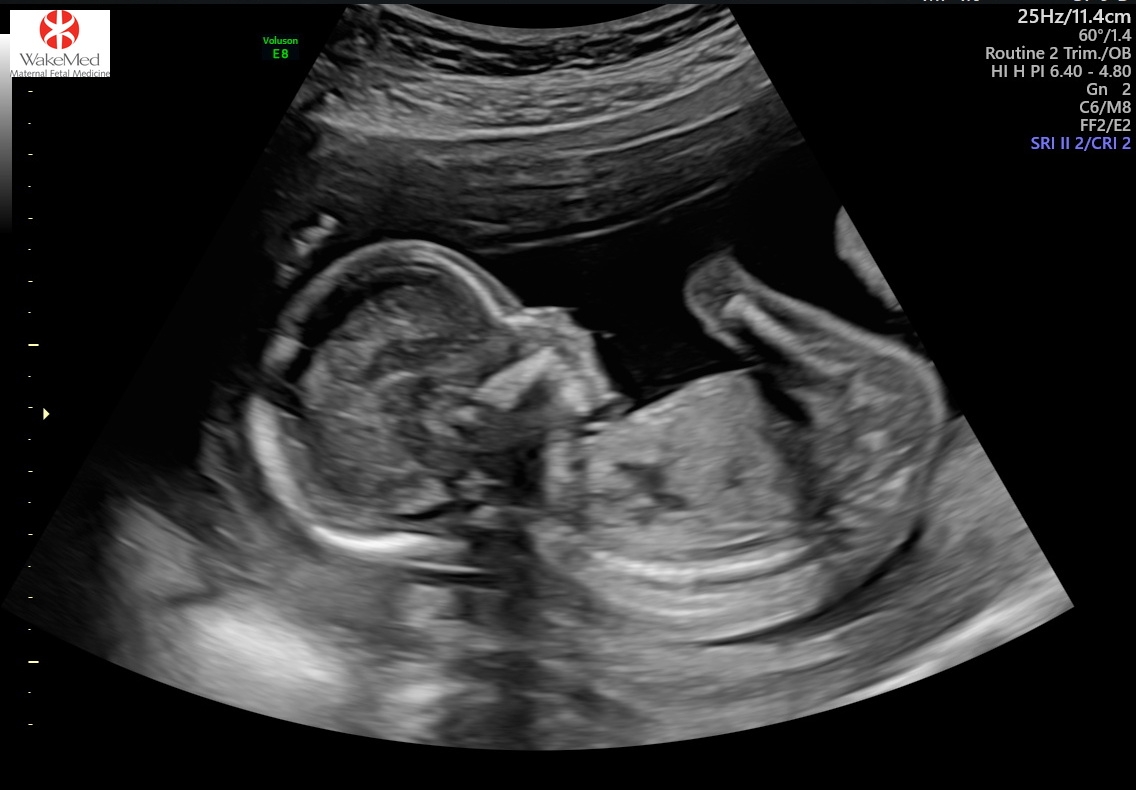 Babylist Registry Photo.
