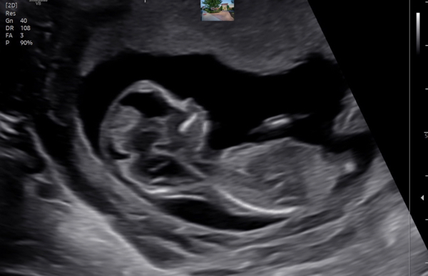 Babylist Registry Photo.