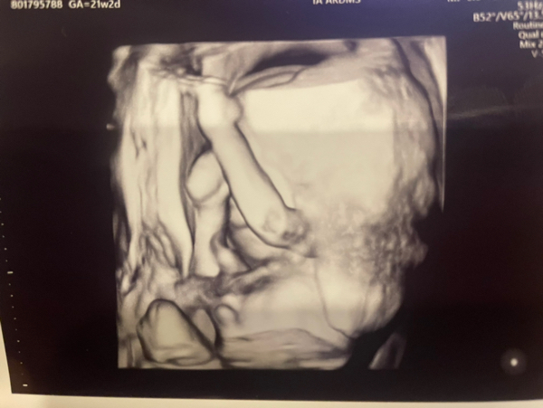 Babylist Registry Photo.