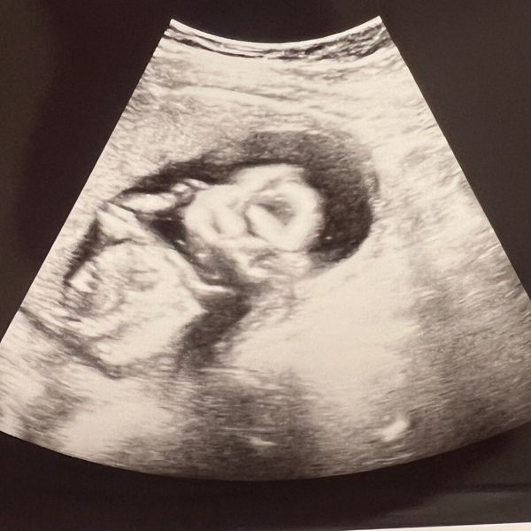 Babylist Registry Photo.