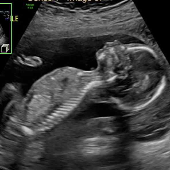 Babylist Registry Photo.