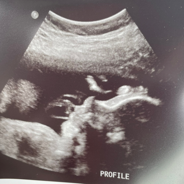 Babylist Registry Photo.