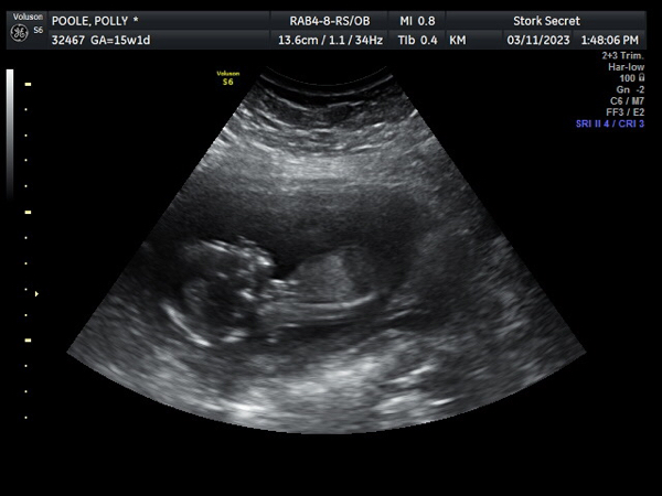 Babylist Registry Photo.
