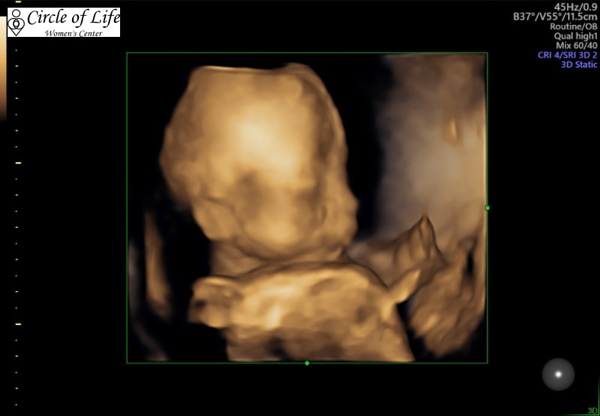 Babylist Registry Photo.