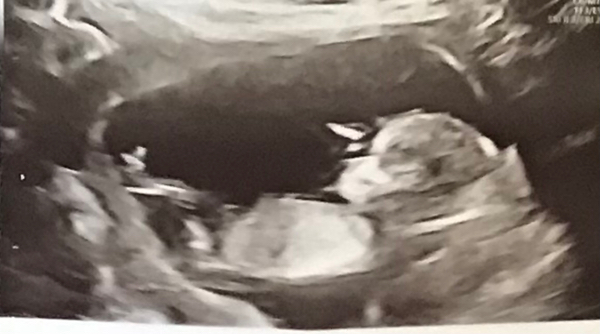 Babylist Registry Photo.