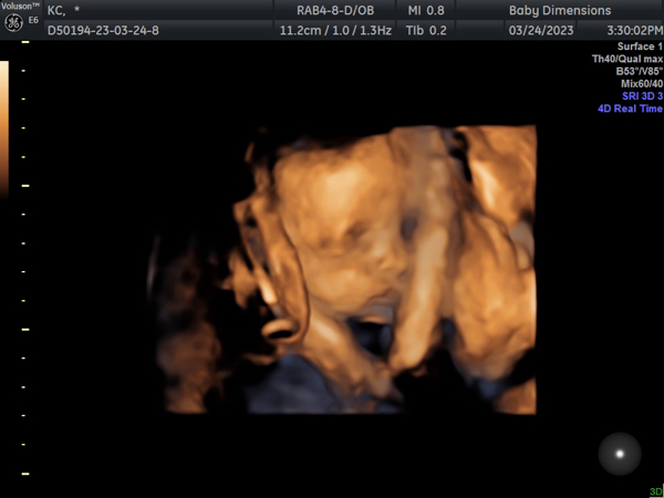 Babylist Registry Photo.