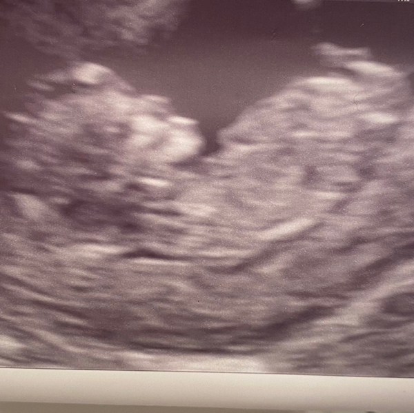 Babylist Registry Photo.