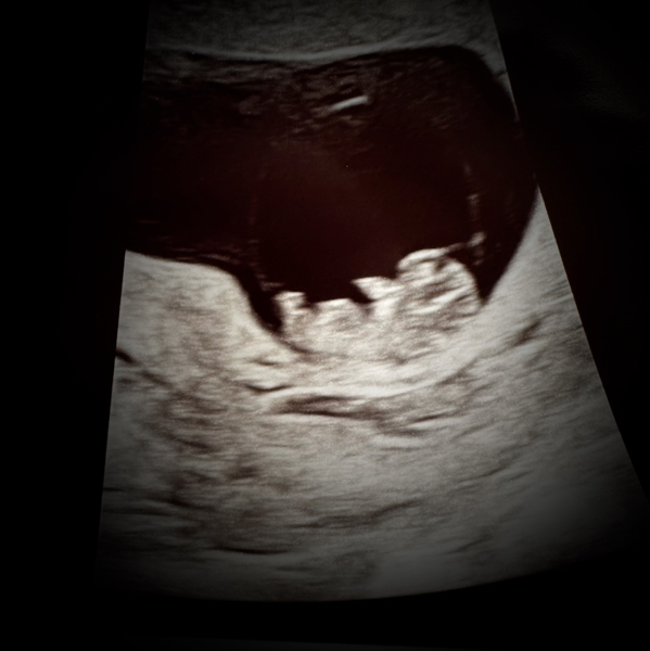 Babylist Registry Photo.