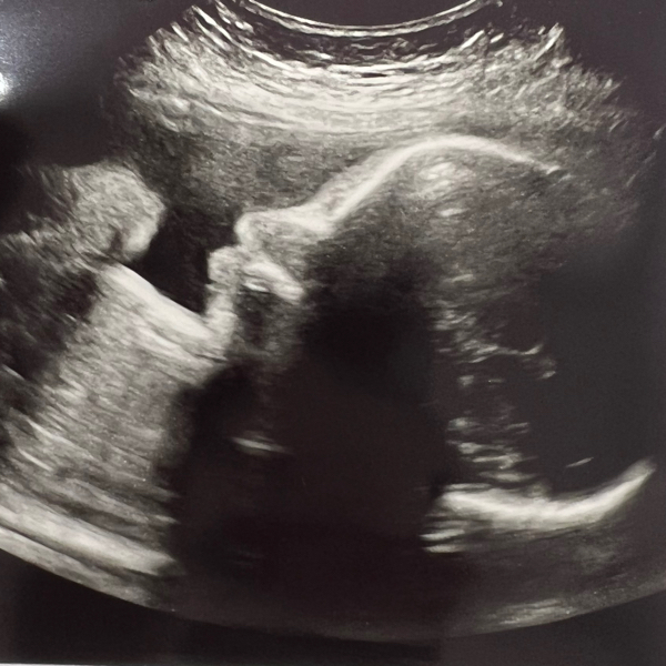 Babylist Registry Photo.