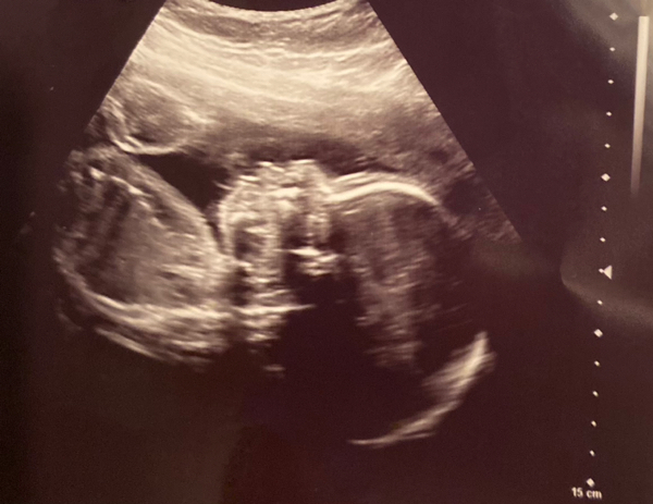 Babylist Registry Photo.