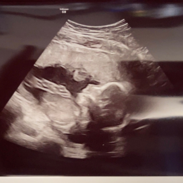 Babylist Registry Photo.