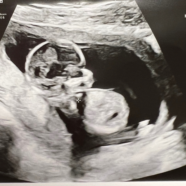 Babylist Registry Photo.