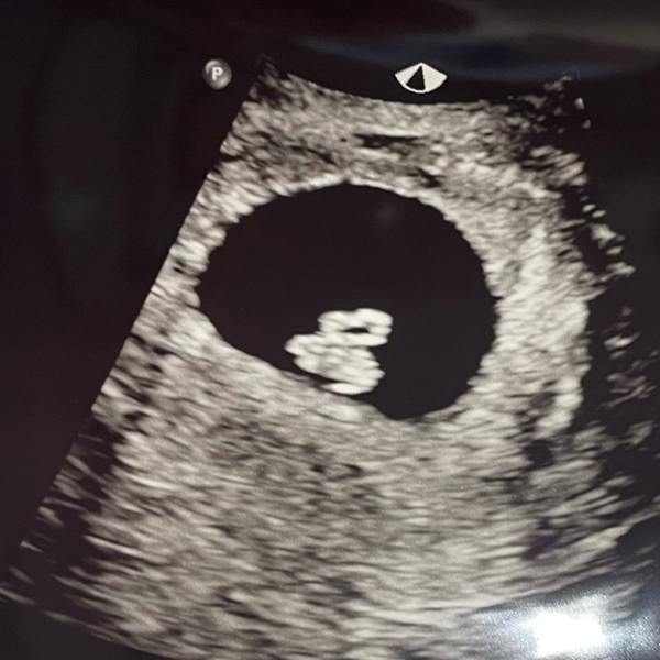 Babylist Registry Photo.