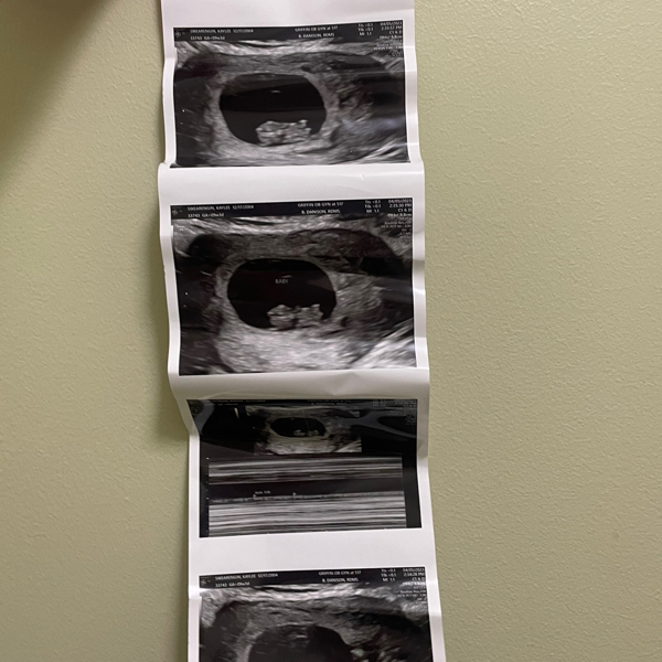 Babylist Registry Photo.