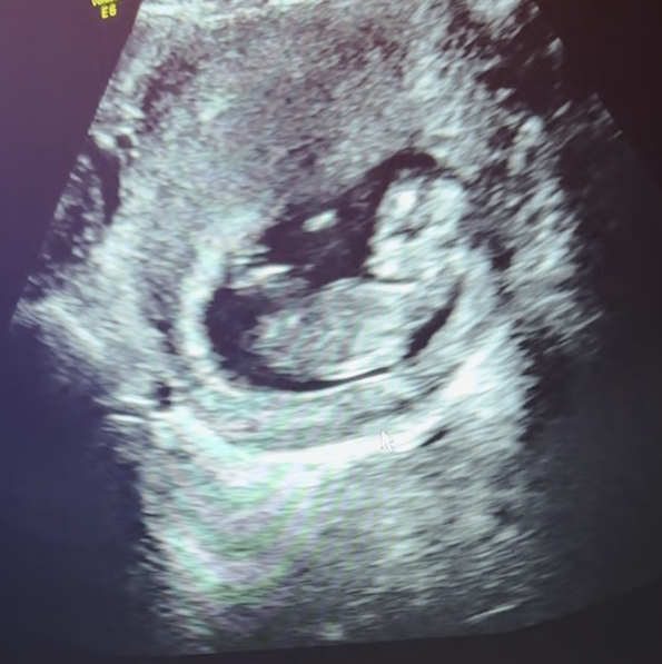 Babylist Registry Photo.